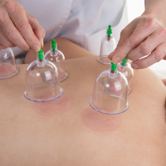 30 Minutes Cupping Therapy