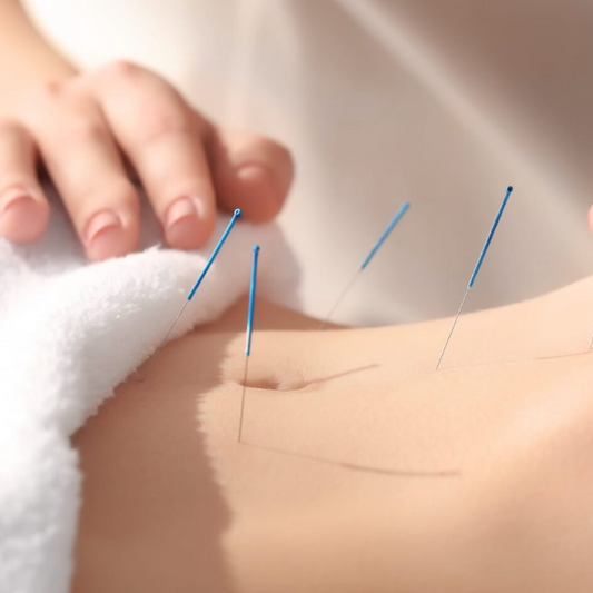60 Minutes Acupuncture
